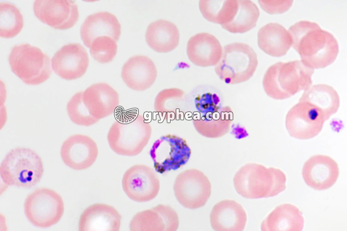 Plasmodium vivax x640 - gryphea.org